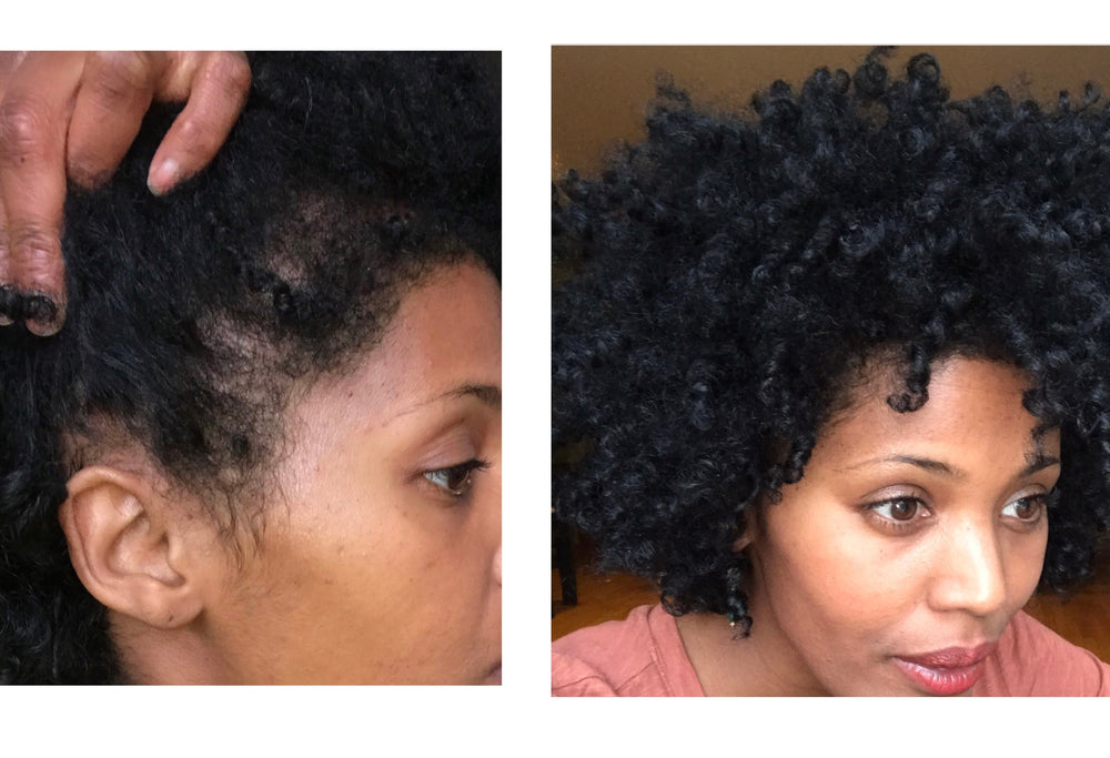 Big Hair Food Hair Growth Results 1 month